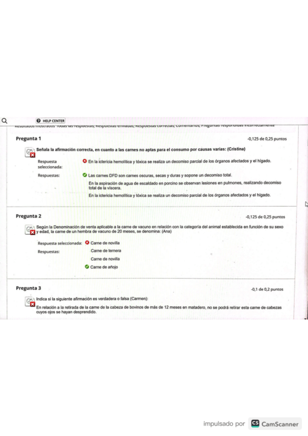 Miniatura del documento Examen-HIGIENE-BLOQUE-B 2023.pdf