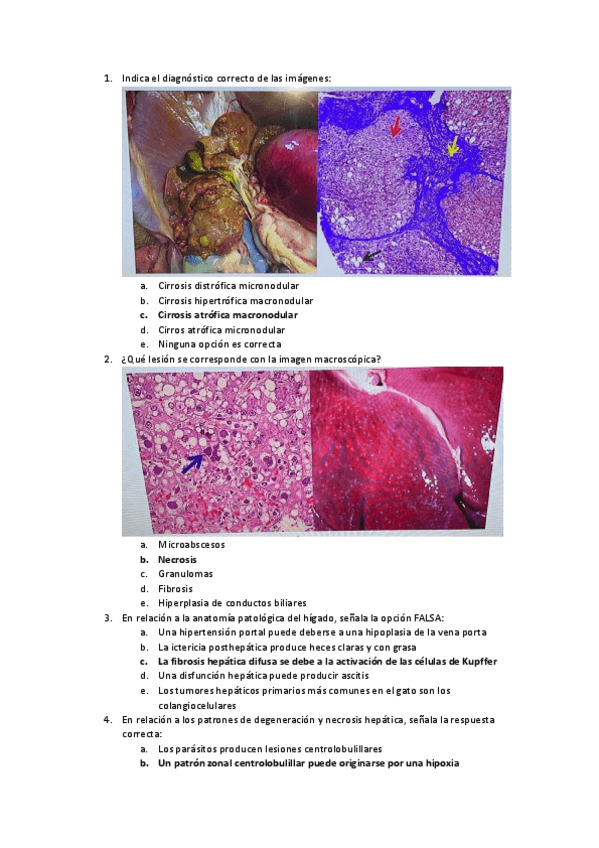 Miniatura del documento Test-3-Parcial-Higado.pdf