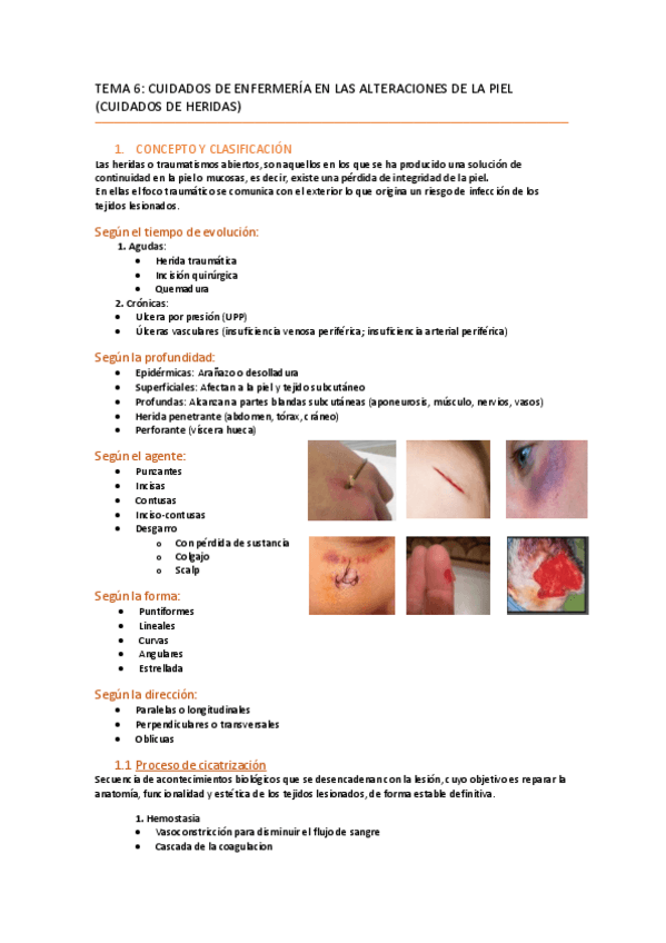 Miniatura del documento Tema 6 Enfermería del Adulto II Heridas y Quemaduras.pdf