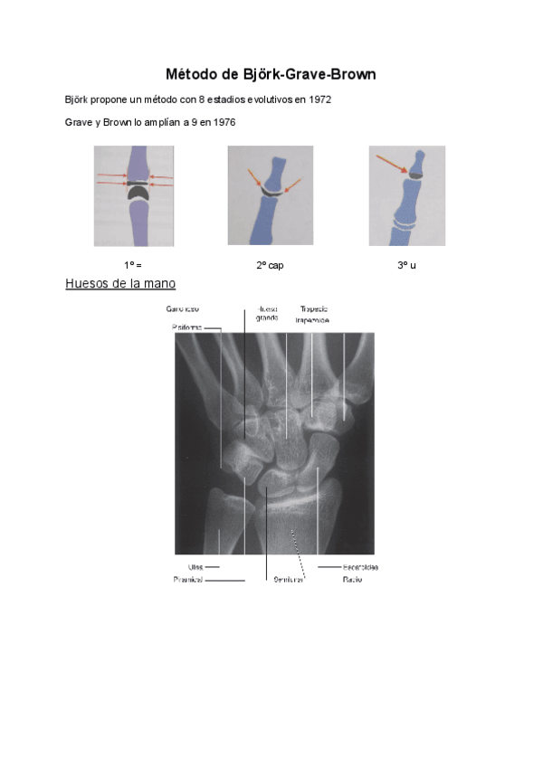 Miniatura del documento Metodo-de-Bjork-Grave-Brown.pdf