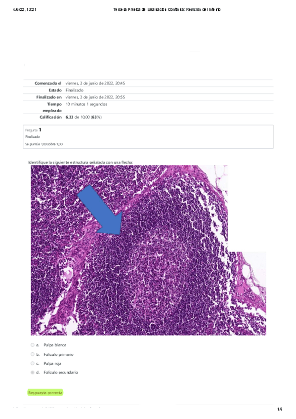Miniatura del documento Tercera-Prueba-de-Evaluacion-Continua-Curso-2021-2022.pdf