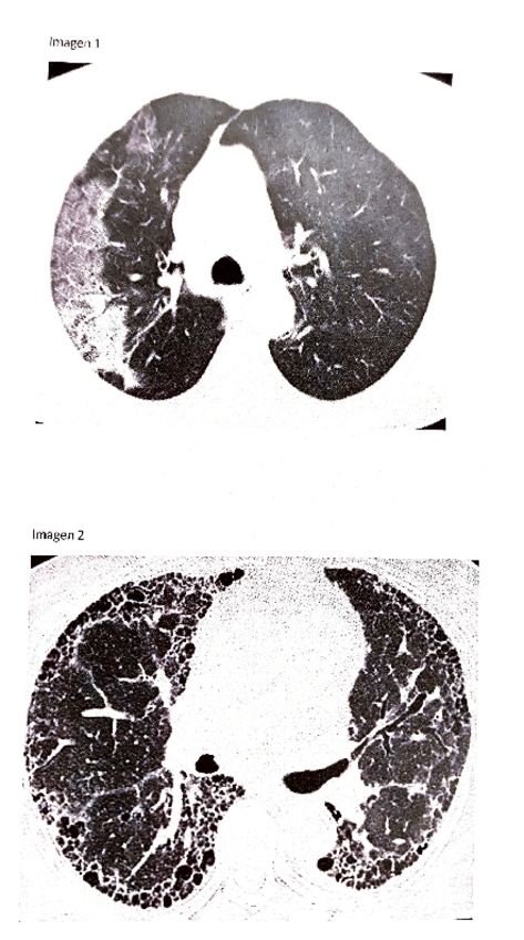 Miniatura del documento imagenes-examen-POSII-MARZO-2022-2.pdf