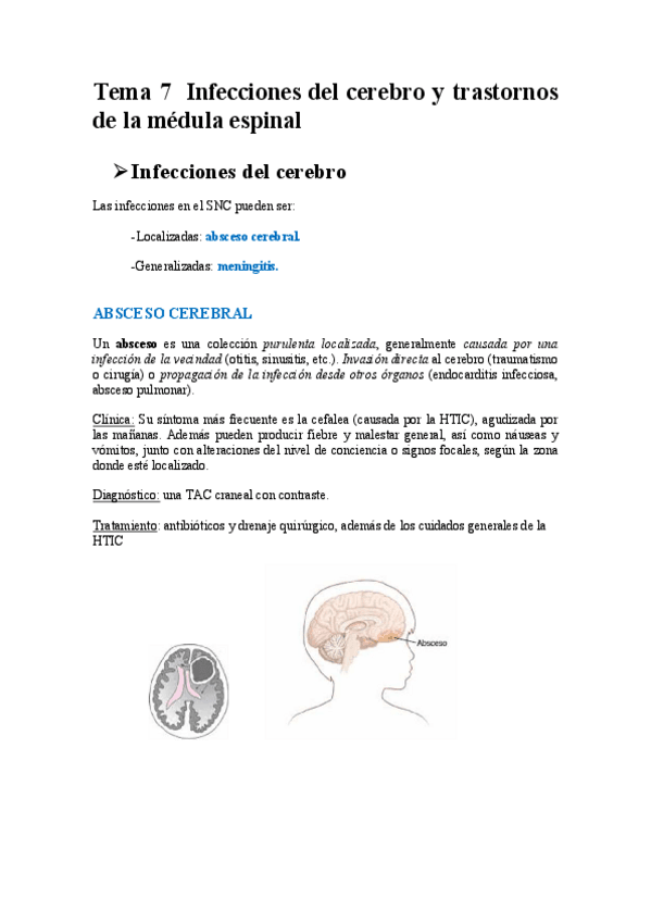 Miniatura del documento Neuro-Tema-7.-Infecciones-cerebro-y-de-medula-espinal.pdf