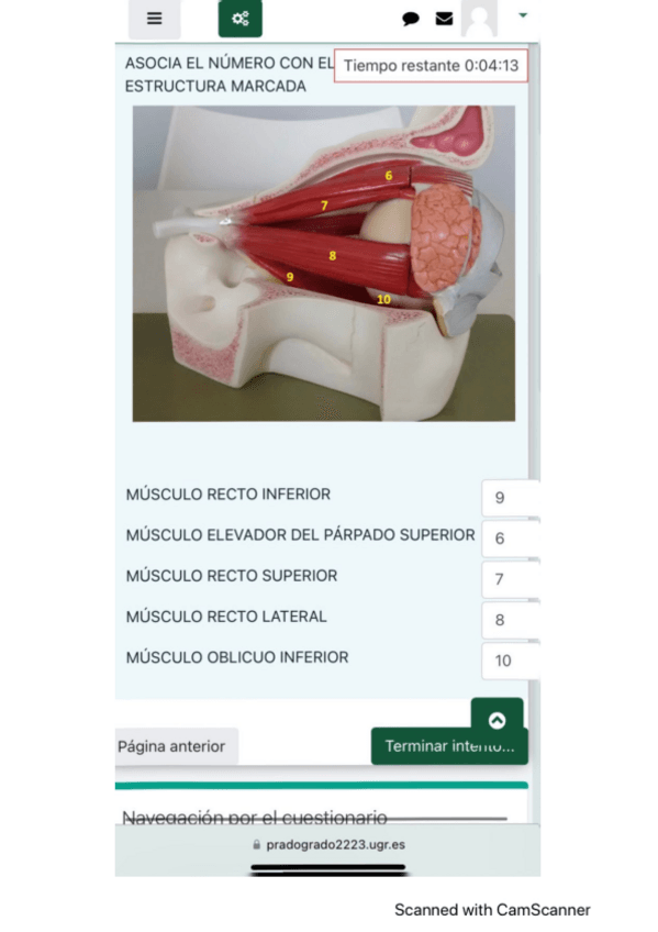 Miniatura del documento Examen-practica-3-ojo-resuelto.pdf
