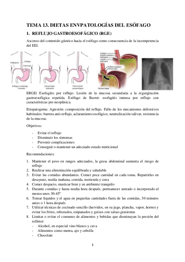 Miniatura del documento TEMA-13.-DIETAS-EN-PATOLOGIAS-DEL-ESOFAGO.pdf