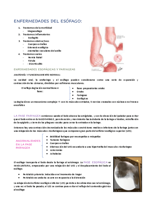 Miniatura del documento ENFERMEDADES-DEL-ESOFAGO.pdf