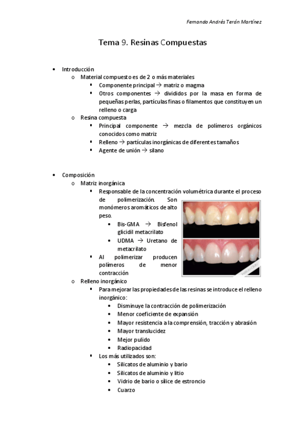 Miniatura del documento Tema-9.-Resinas-Compuestas.pdf
