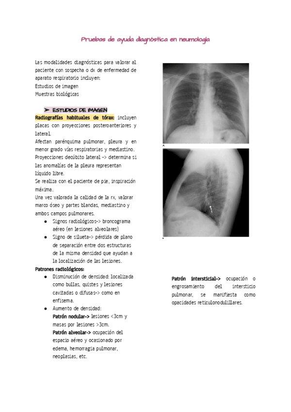 Miniatura del documento Pruebas-de-ayuda-diagnostica-en-neumologia.pdf