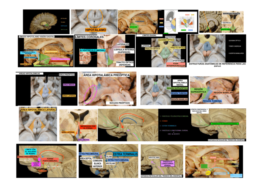 Miniatura del documento IMAGENES-HIPOTALAMO.pdf