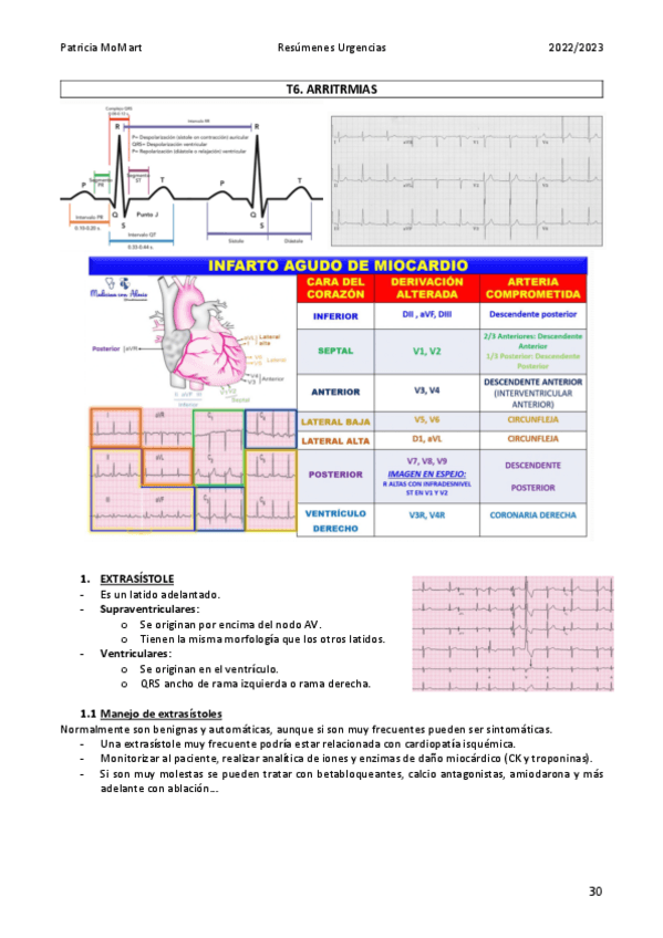 Miniatura del documento T6.-Arritmias.pdf