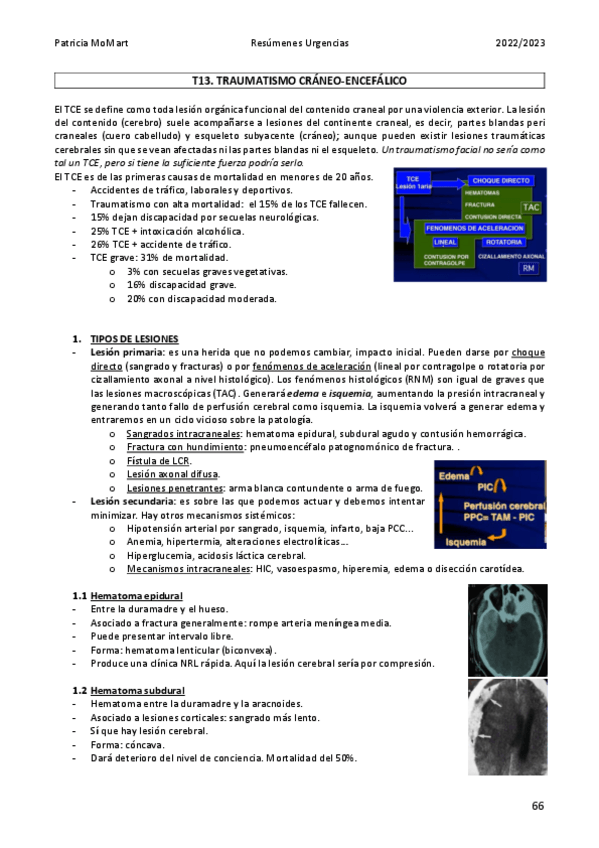 Miniatura del documento T13.-Traumatismo-craneo-encefalico.pdf
