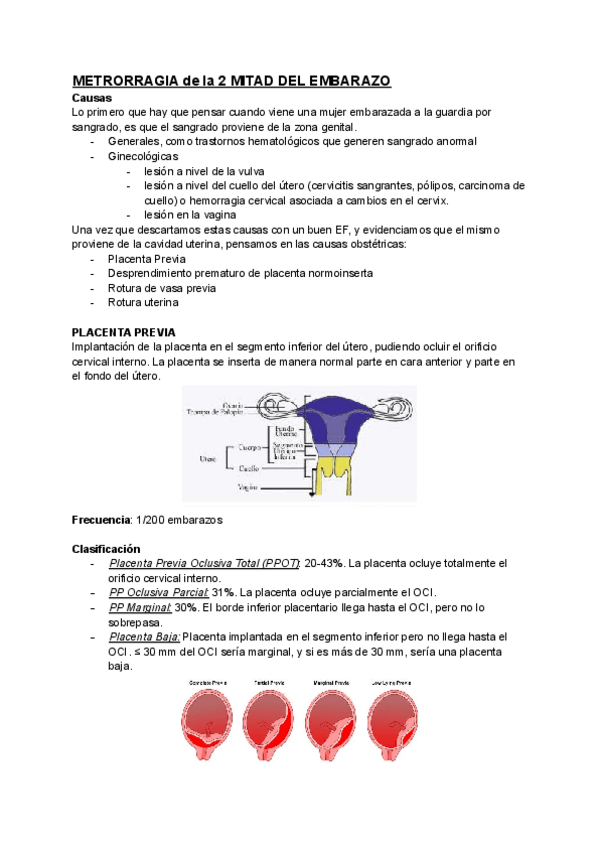 Miniatura del documento METRORRAGIA-de-la-2-MITAD-DEL-EMBARAZO.pdf