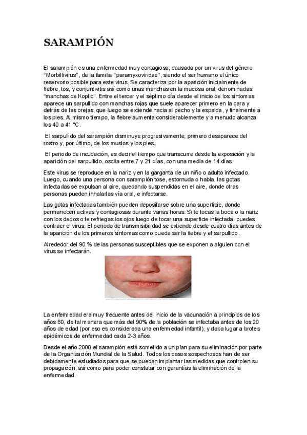 Miniatura del documento Articulo-divulgativo-sobre-Sarampion.pdf