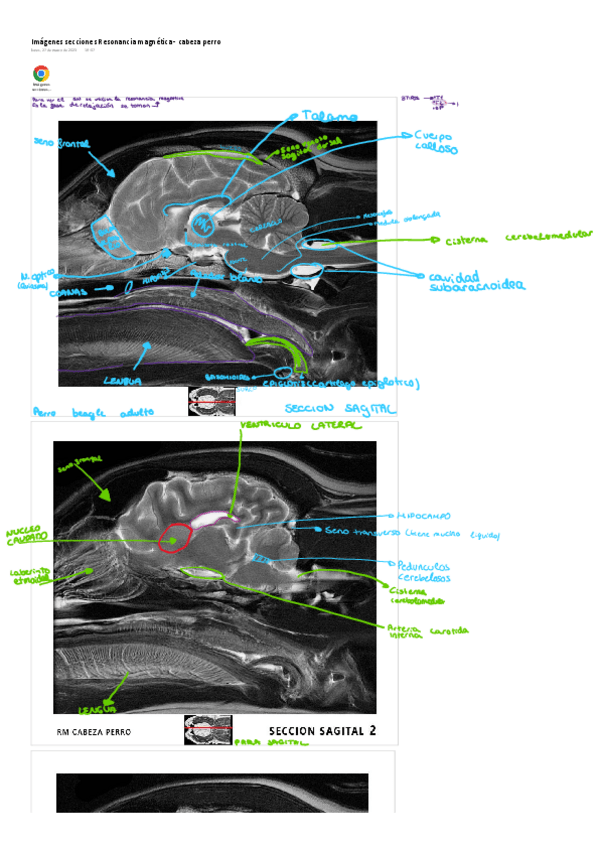 Miniatura del documento IMAGENES SECCIONES ANATOMIA II.pdf