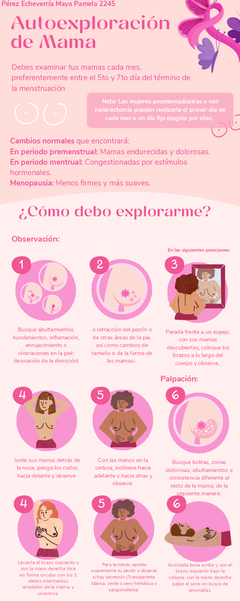 Miniatura del documento Infografia-Autoexploracion-de-mama.pdf