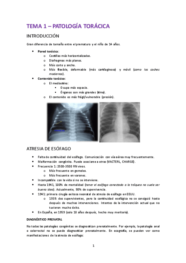 Miniatura del documento 1.-Patologia-quirurgica-toracica-pediatrica.pdf