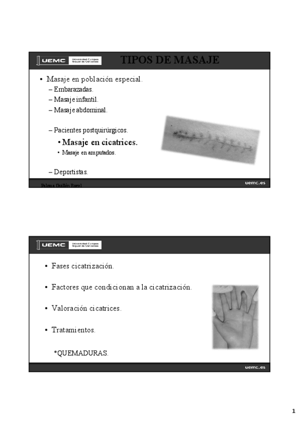 Miniatura del documento 4.4-Masaje-cicatriz.pdf