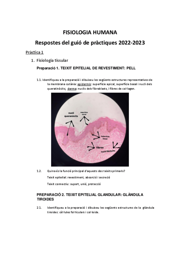 Miniatura del documento respostes-practiques-fisio.pdf