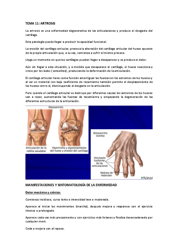 Miniatura del documento TEMA-11-ARTROSIS.pdf