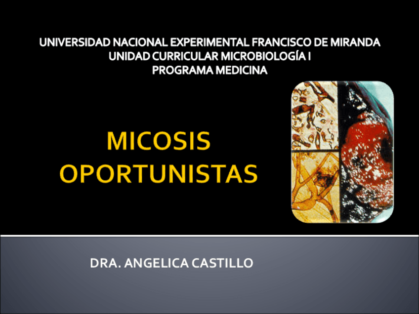 Miniatura del documento TEMA-7MICOSIS-OPORTUNISTAS.pdf