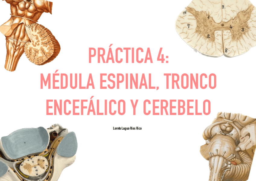 Miniatura del documento Practica-4-Medula-Tronco-Y-Cerebelo.pdf