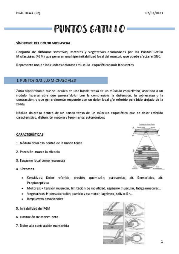 Miniatura del documento PUNTOS-GATILLO.pdf