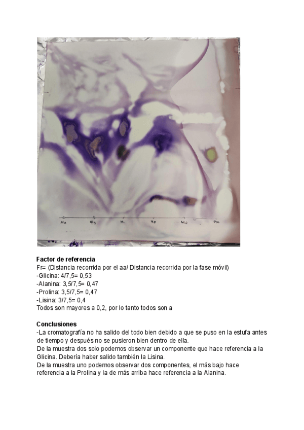 Miniatura del documento Cromatografia.pdf