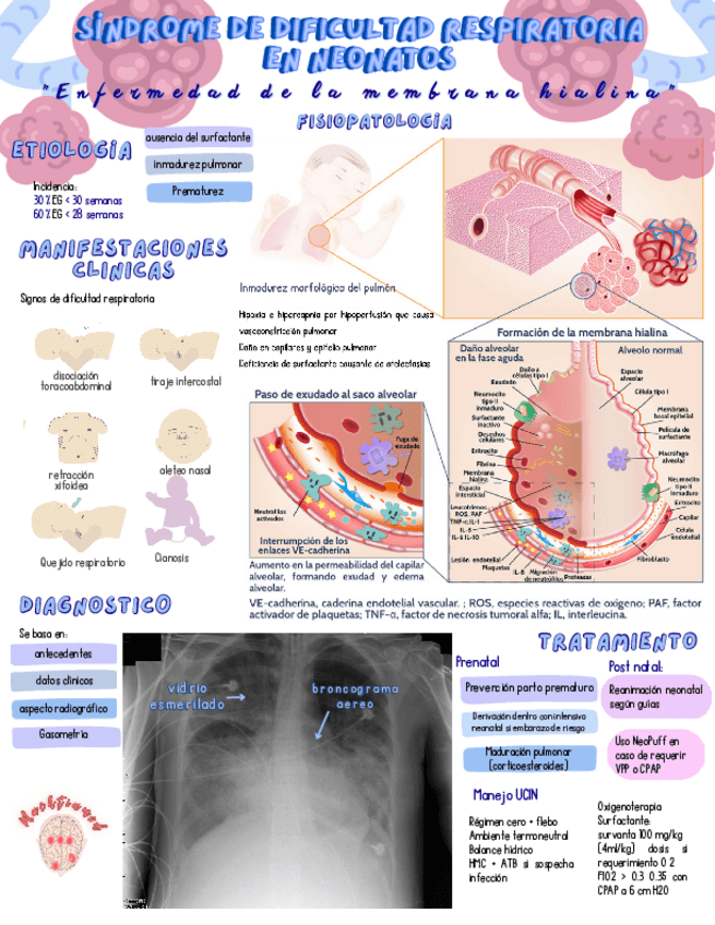 Miniatura del documento Sindrome-de-dificultad-respiratoria.pdf