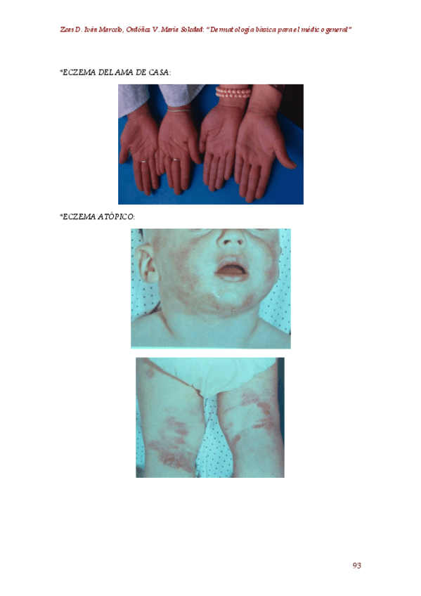 Miniatura del documento 02.-Dermatologia-basica-para-el-medico-general-autor-Zeas-D.-Ivan-Marcelo-Ordonez-V.-Maria-Soledad-5.pdf