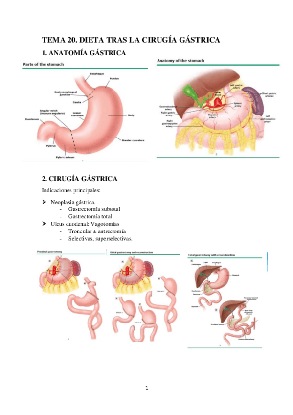 Miniatura del documento TEMA-20.-DIETA-TRAS-LA-CIRUGIA-GASTRICA.pdf