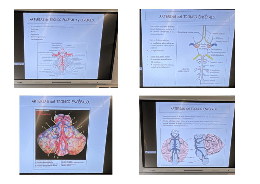 Miniatura del documento Arterias-del-troncoencefalo-y-cerebelo.pdf