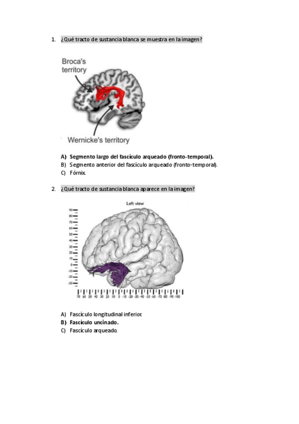 Miniatura del documento EXAMEN-BLOQUE-3-F.-PSICOBIOLOGIA-II-RESPUESTAS-CLARAS.pdf.pdf