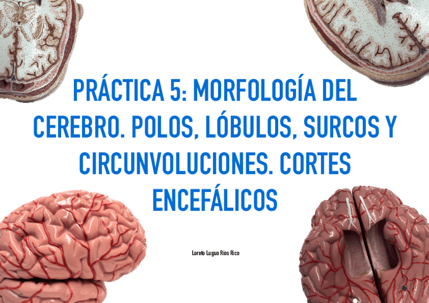 Miniatura del documento PRACTICA-5-MORFOLOGIA-DEL-CEREBRO.-POLOS-LOBULOS-SURCOS-Y-CIRCUNVOLUCIONES.-CORTES-ENCEFALICOS.pdf