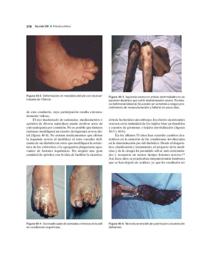 Miniatura del documento Pie-Diabetico-Atencion-Integral-S-29.pdf