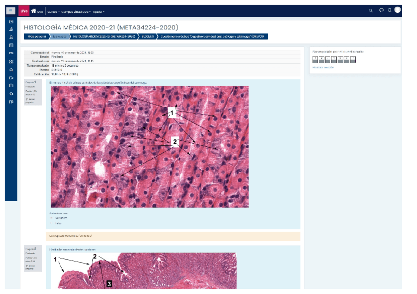 Miniatura del documento EVALUACION-CONTINUA-DIGESTIVO-I-CURSO-2020-21.pdf
