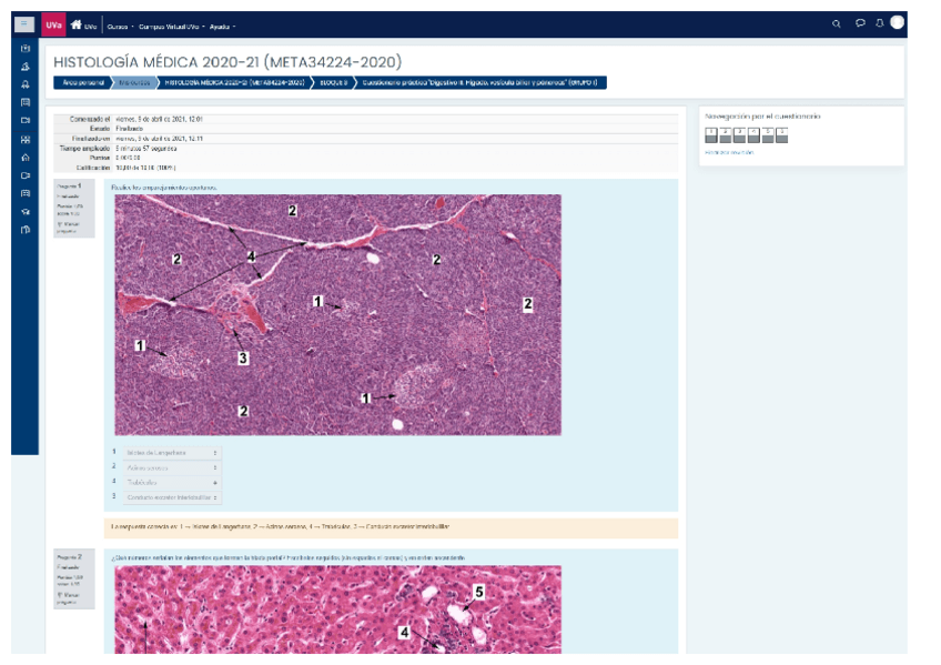 Miniatura del documento EVALUACION-CONTINUA-DIGESTIVO-III-CURSO-2020-21.pdf