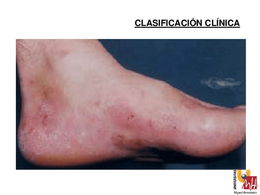 Miniatura del documento T7-Dermatomicosis-2013-14-3.pdf