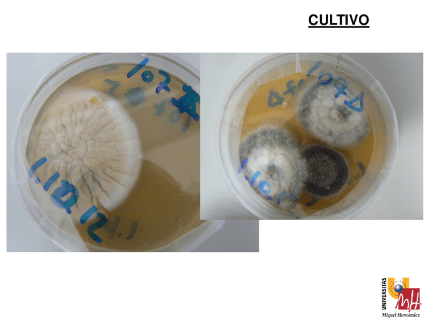 Miniatura del documento T7-Dermatomicosis-2013-14-4.pdf