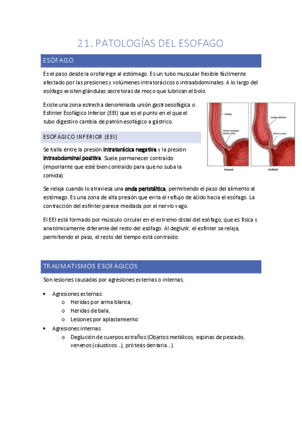 Miniatura del documento T21.-Patologias-del-esofago.pdf