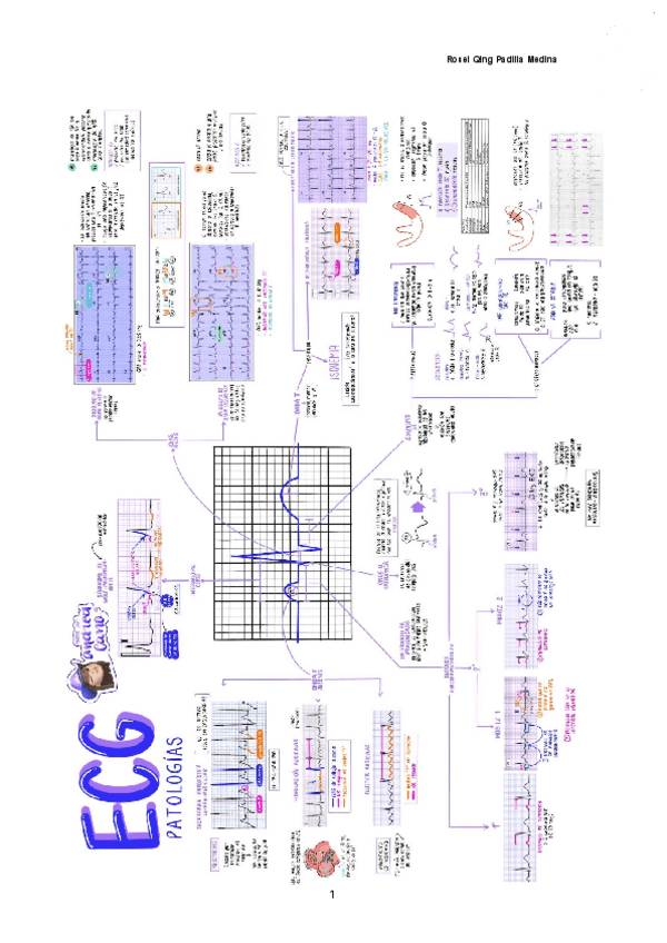 Miniatura del documento ECG-PATOLOGICO-Documentos-de-Google.pdf