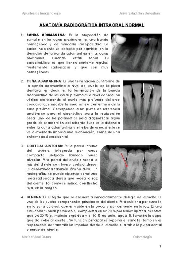 Miniatura del documento Anatomia-Radiografica-Intraoral-Normal.pdf