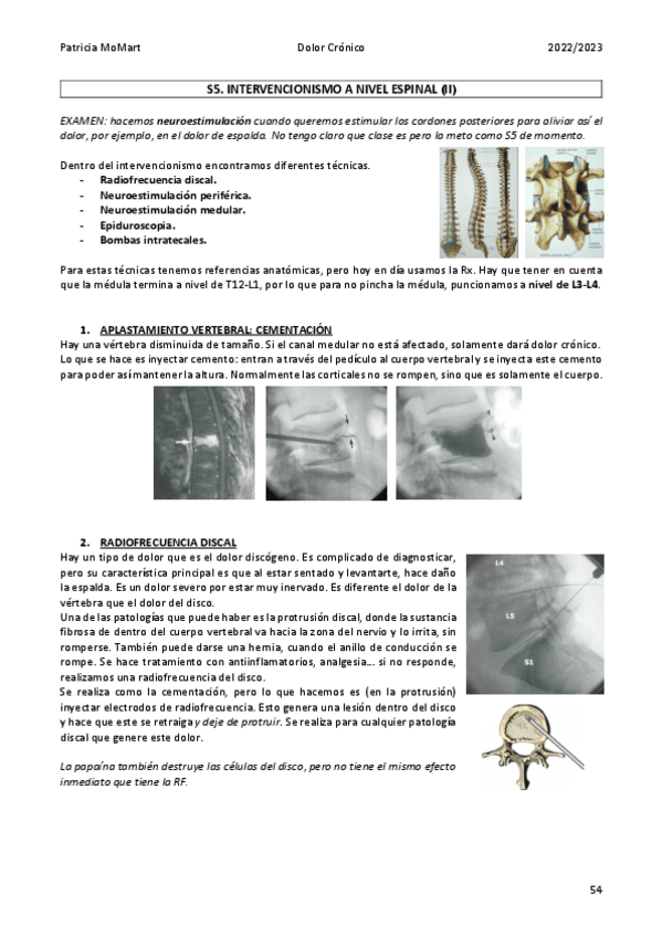 Miniatura del documento S5.-Intervencionismo-a-nivel-espinal-II.pdf