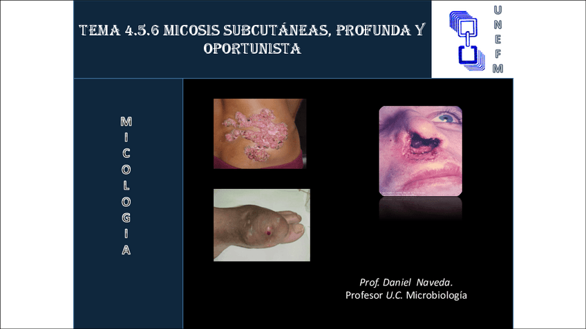 Miniatura del documento MICOSIS SUBCUTÁNEA.pdf