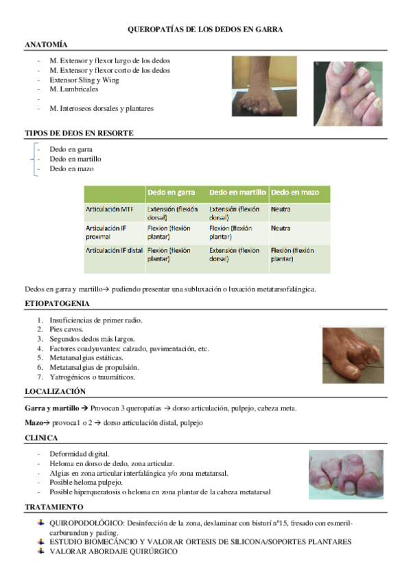 Miniatura del documento QUEROPATIAS-DE-LOS-DEDOS-EN-GARRA.pdf