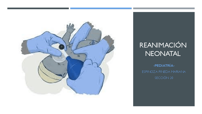 Miniatura del documento Reanimacion-Neonatal.pdf