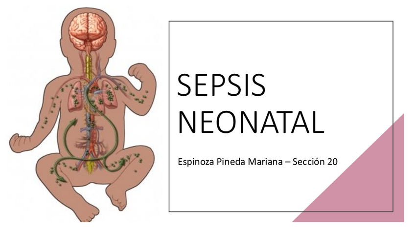 Miniatura del documento SEPSIS-NEONATAL.pdf