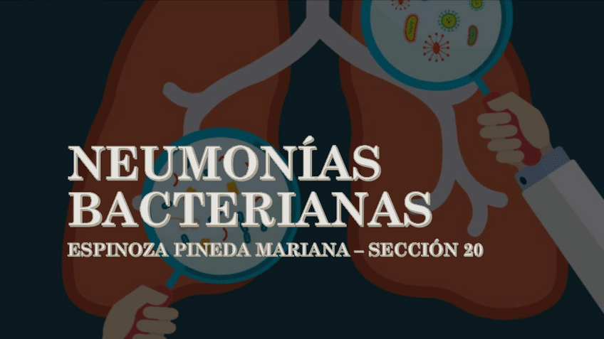 Miniatura del documento Neumonias-bacterianas.pdf