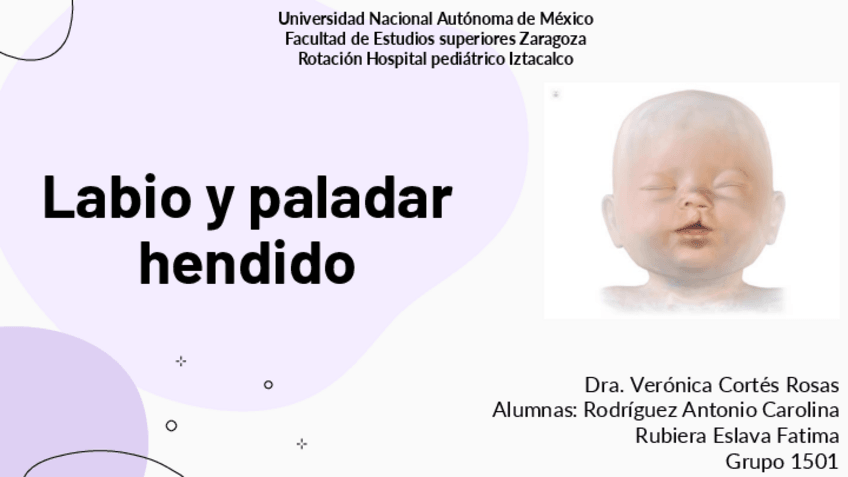 Miniatura del documento Labio-y-paladar-hendido.pdf