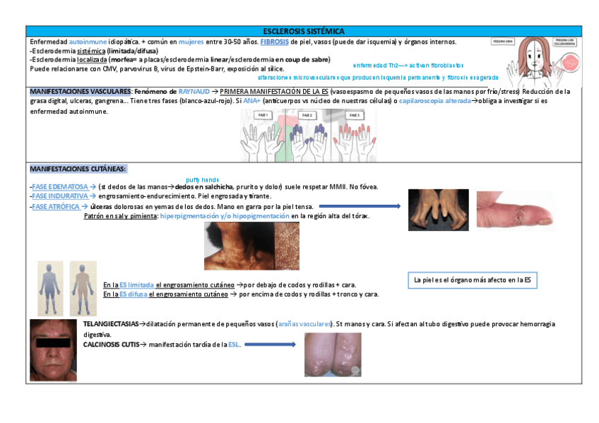Miniatura del documento ESCLEROSIS-SISTEMICA.pdf