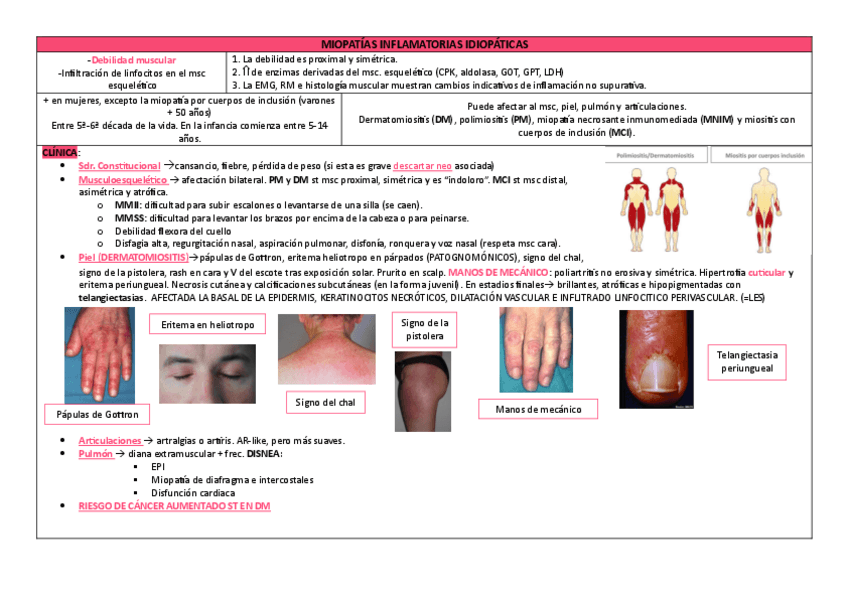 Miniatura del documento MIOPATIAS-INFLAMATORIAS-IDIOPATICAS.pdf